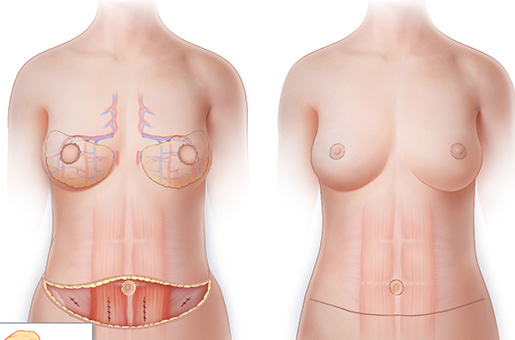 Breast Anatomy - Tomball, TX: General & Minimally Invasive Surgery